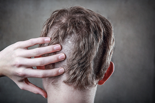 Bad Haircut Barber Liability - Haircut Accident