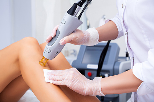 laser-hair-removal laser hair removal accident