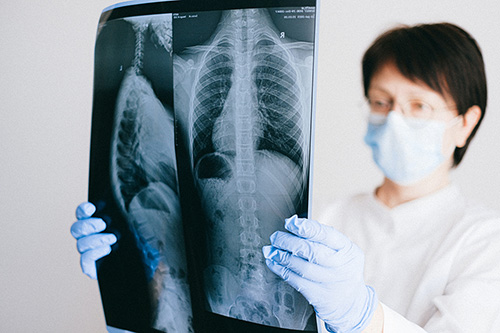 Nurse-xray