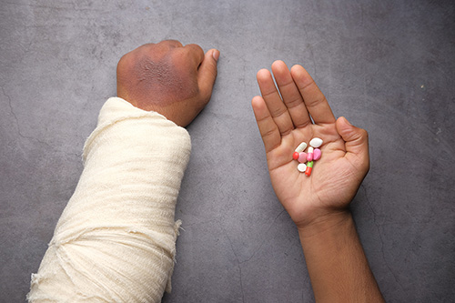 broken-arm broken arm